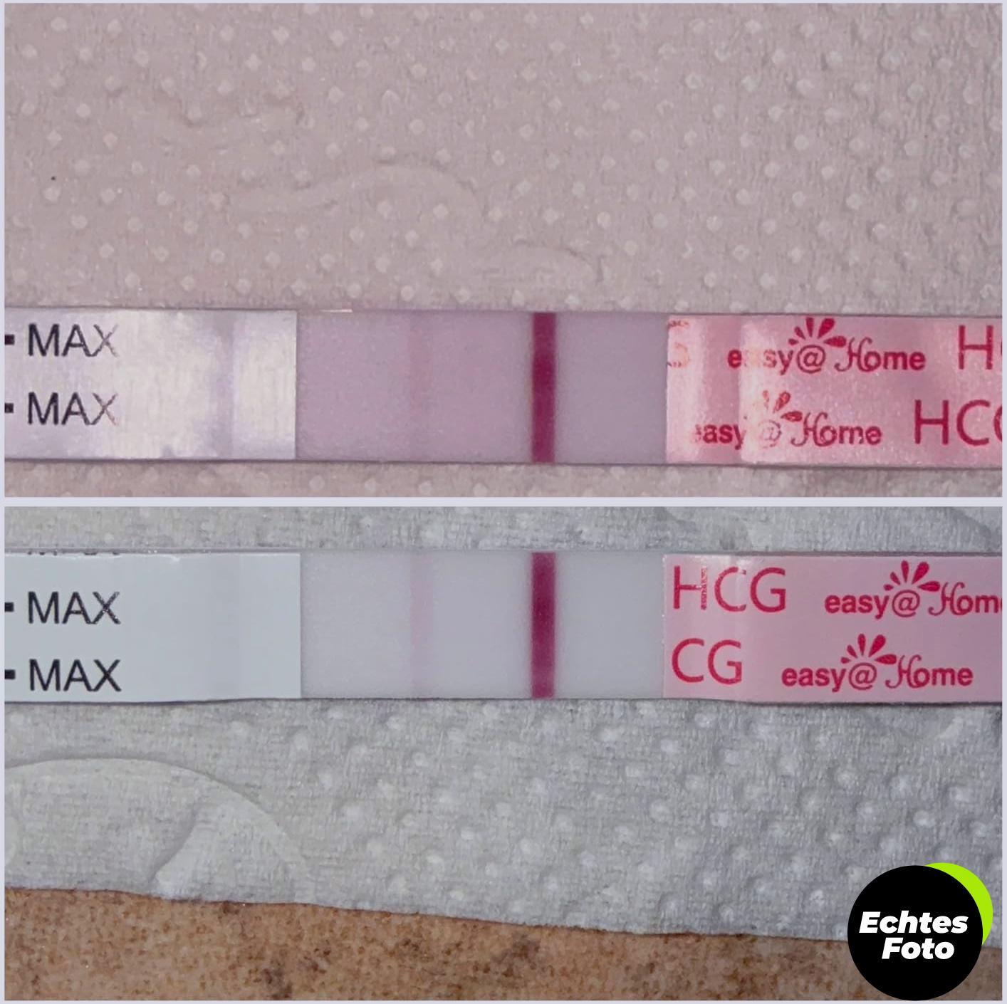 easypregnancy-20-teststreifen-easyhome-fruehtest-10miuml-foto-1