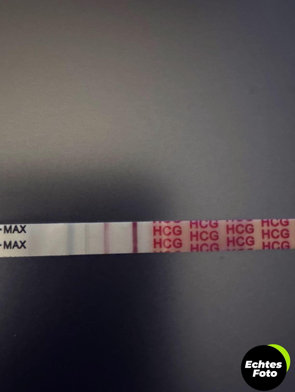wondfo-schwangerschaftstest-20er-set-fruehschwangerschaftstest-10miu-ml-foto-1